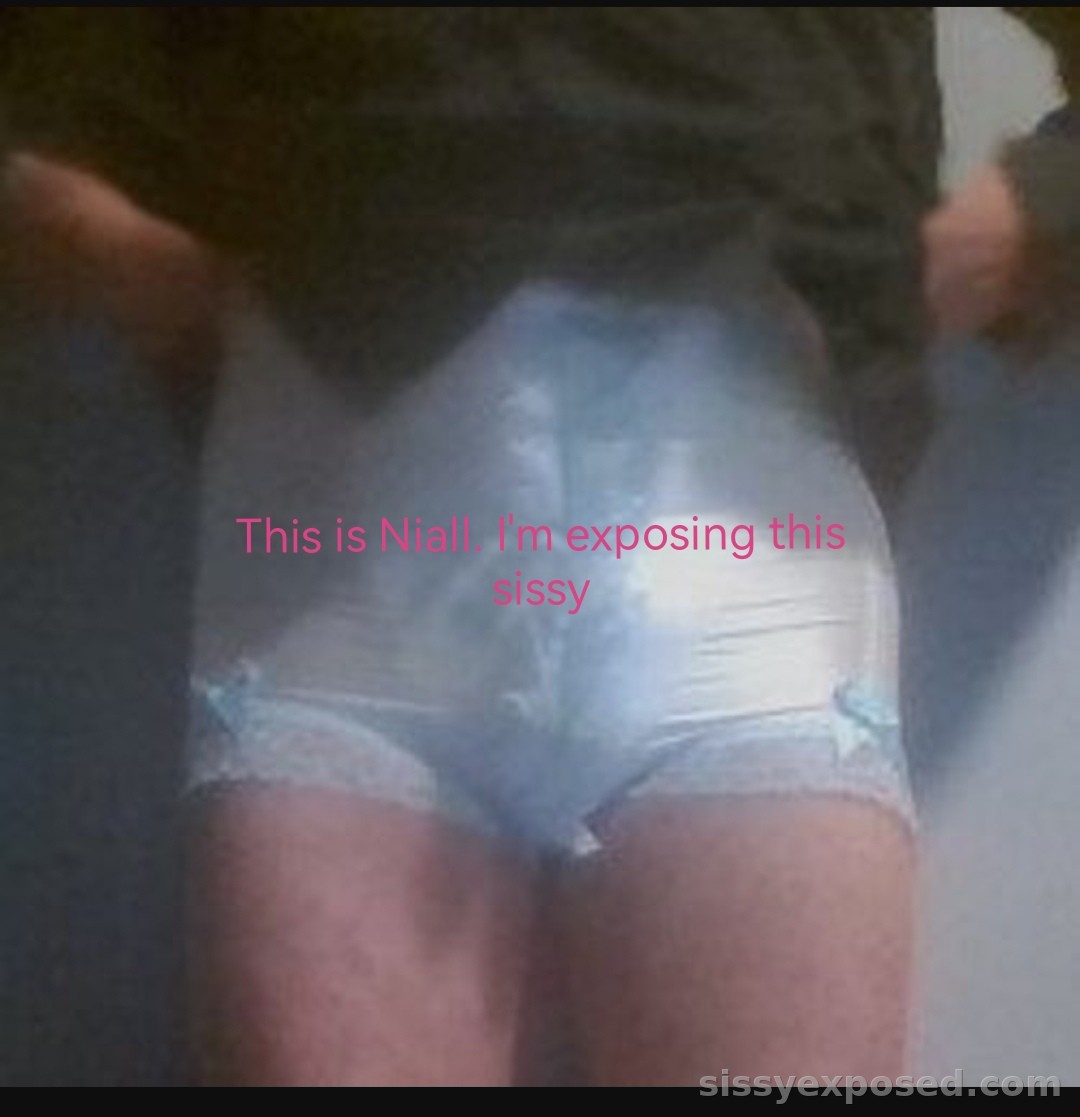 Exposing Niall